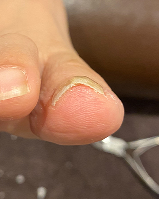 AFTER